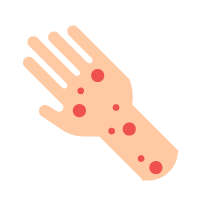 Pictogramme représentant une allergie sur la main